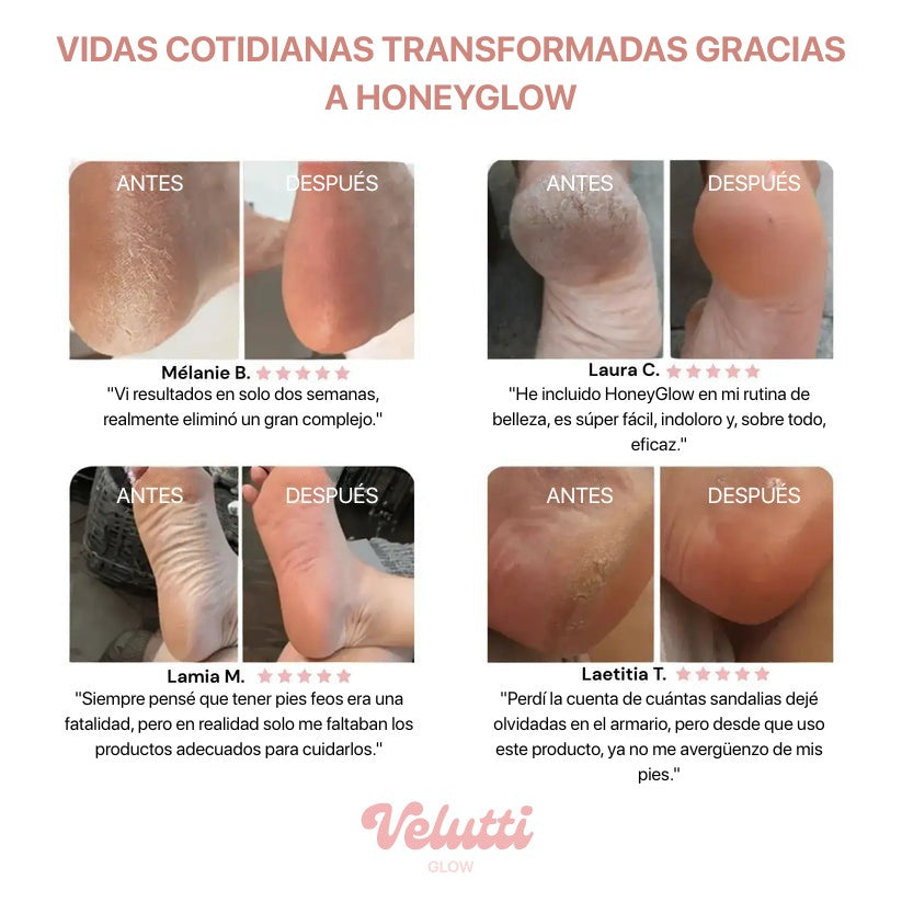 ✨ HoneyGlow™ – Kit Belleza Pies